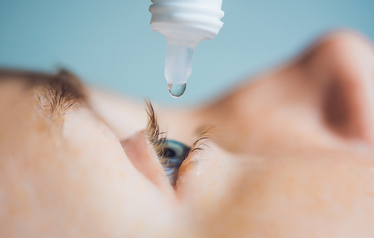 Glaucoma